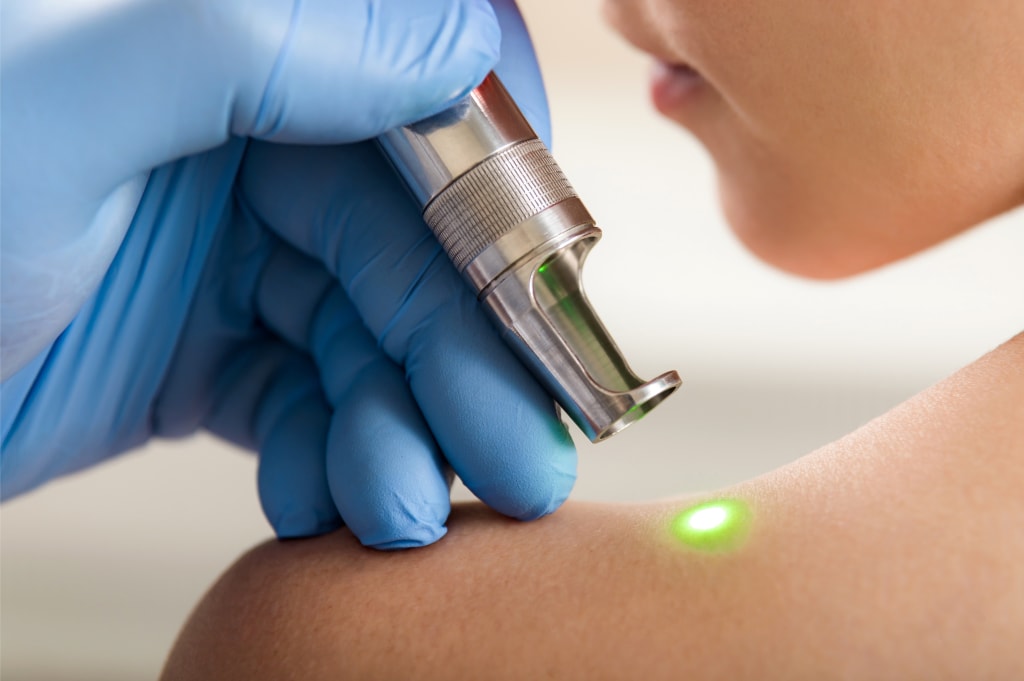 Cuidado de la piel tras tratamientos dermatológicos
